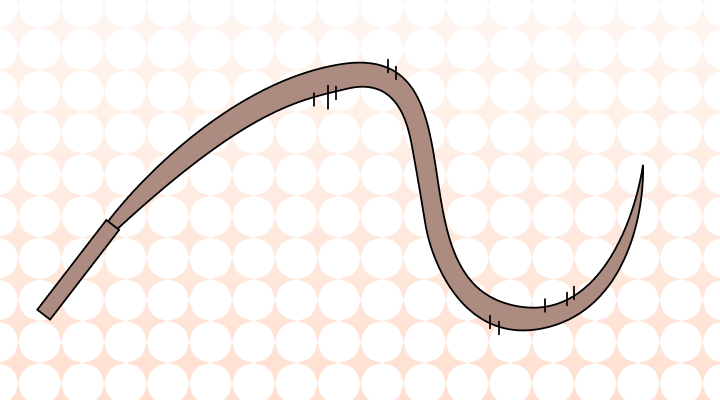 Whiplash 뜻과 예시 (편타 손상)